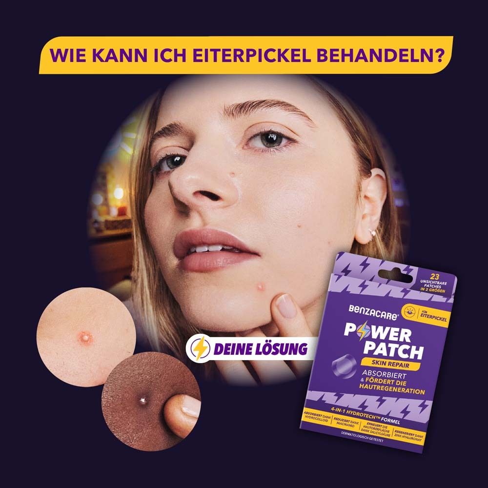 Frau mit Pickel, daneben Benzacare Power Patch Skin Repair. Produkt und Anwendung im Bild. Text: Deine Lösung.