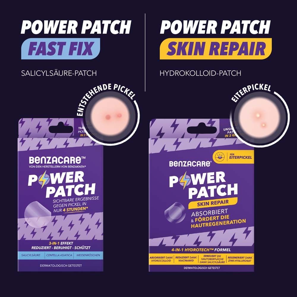 Zwei Packungen Benzacare Power Patch. Links: Fast Fix. Rechts: Skin Repair. Beide mit Produktabbildung und Text.