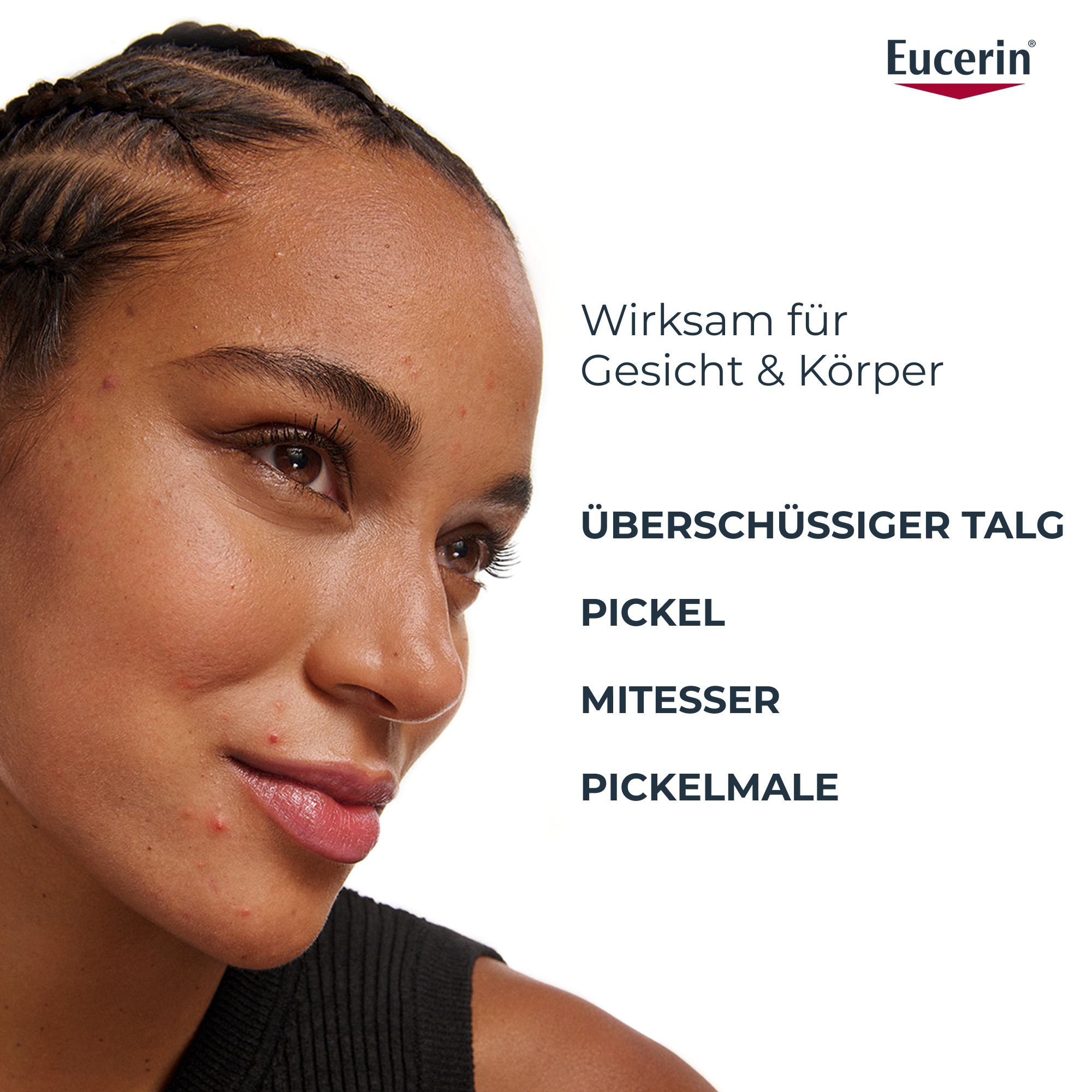 Frau mit Hautunreinheiten. Text: Wirksam für Gesicht & Körper. Überschüssiger Talg, Pickel, Mitesser, Pickelmale.