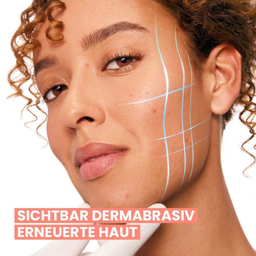 Gesicht einer Frau mit blauen Linien. Text: Sichtbar dermabrasiv erneuerte Haut.