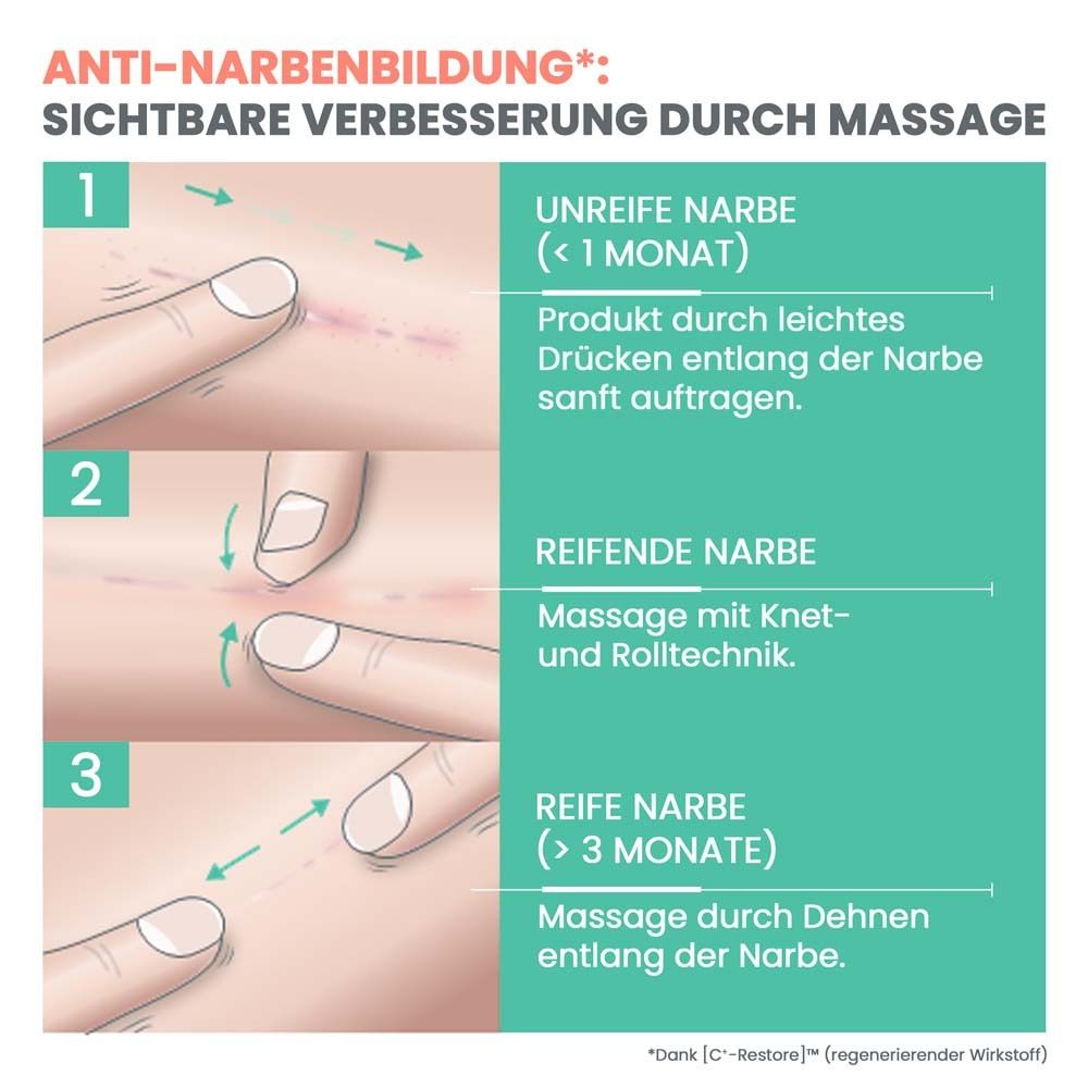 Anleitung zur Narbenmassage. Text: Unreife, reifende und reife Narben. 3 Schritte.