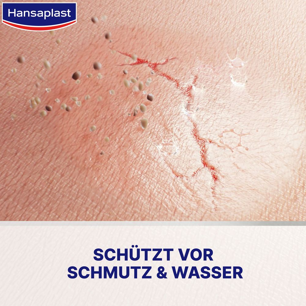 Nahaufnahme von Haut mit Riss. Text: Schützt vor Schmutz & Wasser.