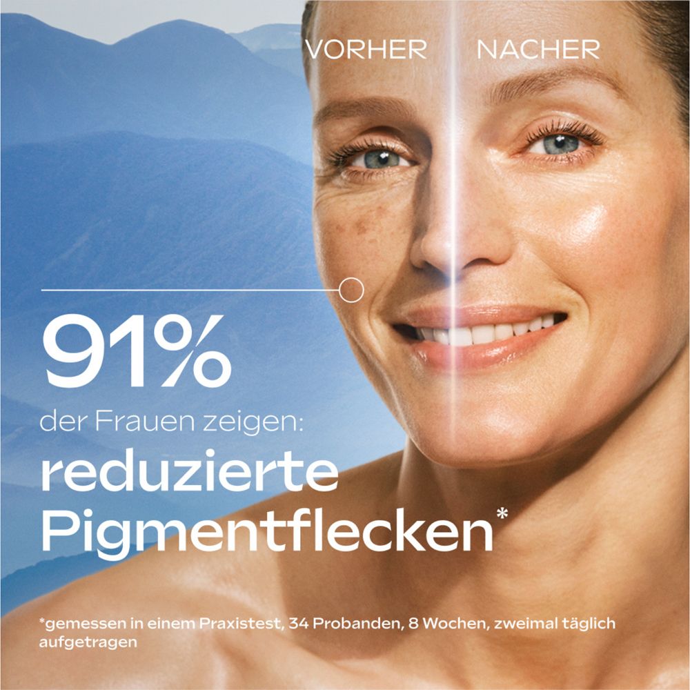 Gesicht einer Frau. Vorher-Nachher-Vergleich. Text: 91% der Frauen zeigen reduzierte Pigmentflecken.