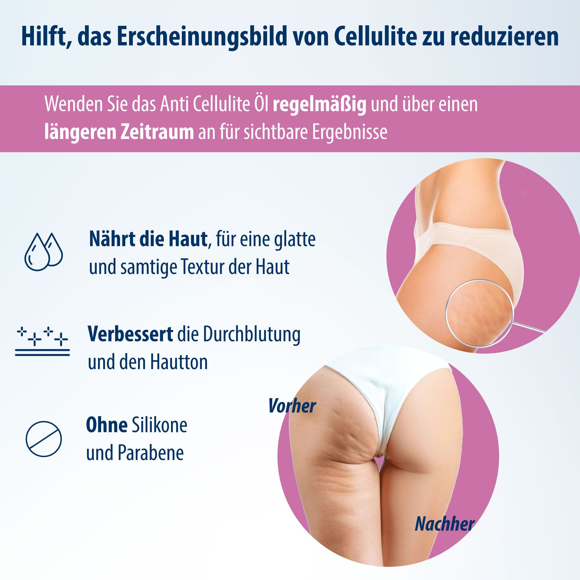 Infografik zum Anti Cellulite Öl. Zeigt Vorher-Nachher-Effekt. Nährt die Haut, verbessert Durchblutung, ohne Silikone und Parabene.