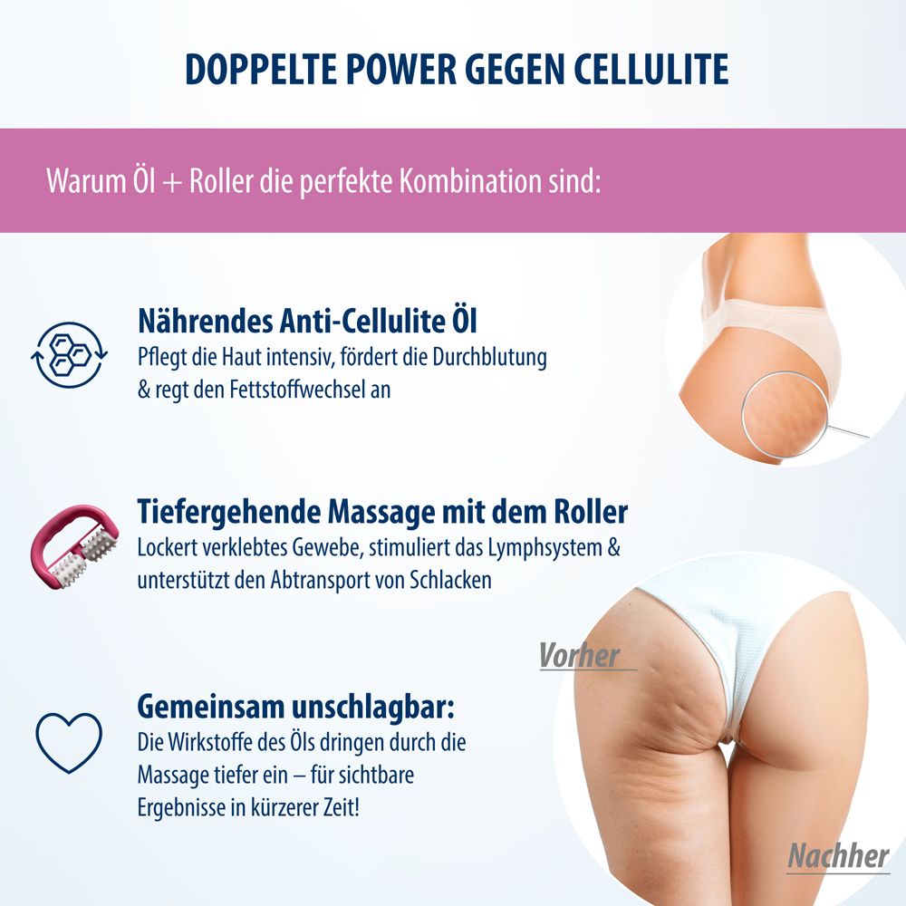 Vergleich von Cellulite: Vorher und Nachher, mit Erläuterung der Öl- und Roller-Kombination.