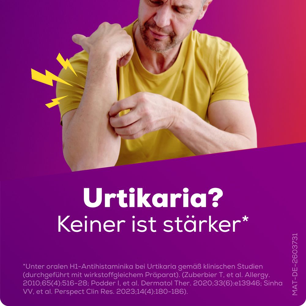 Urtikaria? Keiner ist stärker. Mann kratzt sich am Arm.