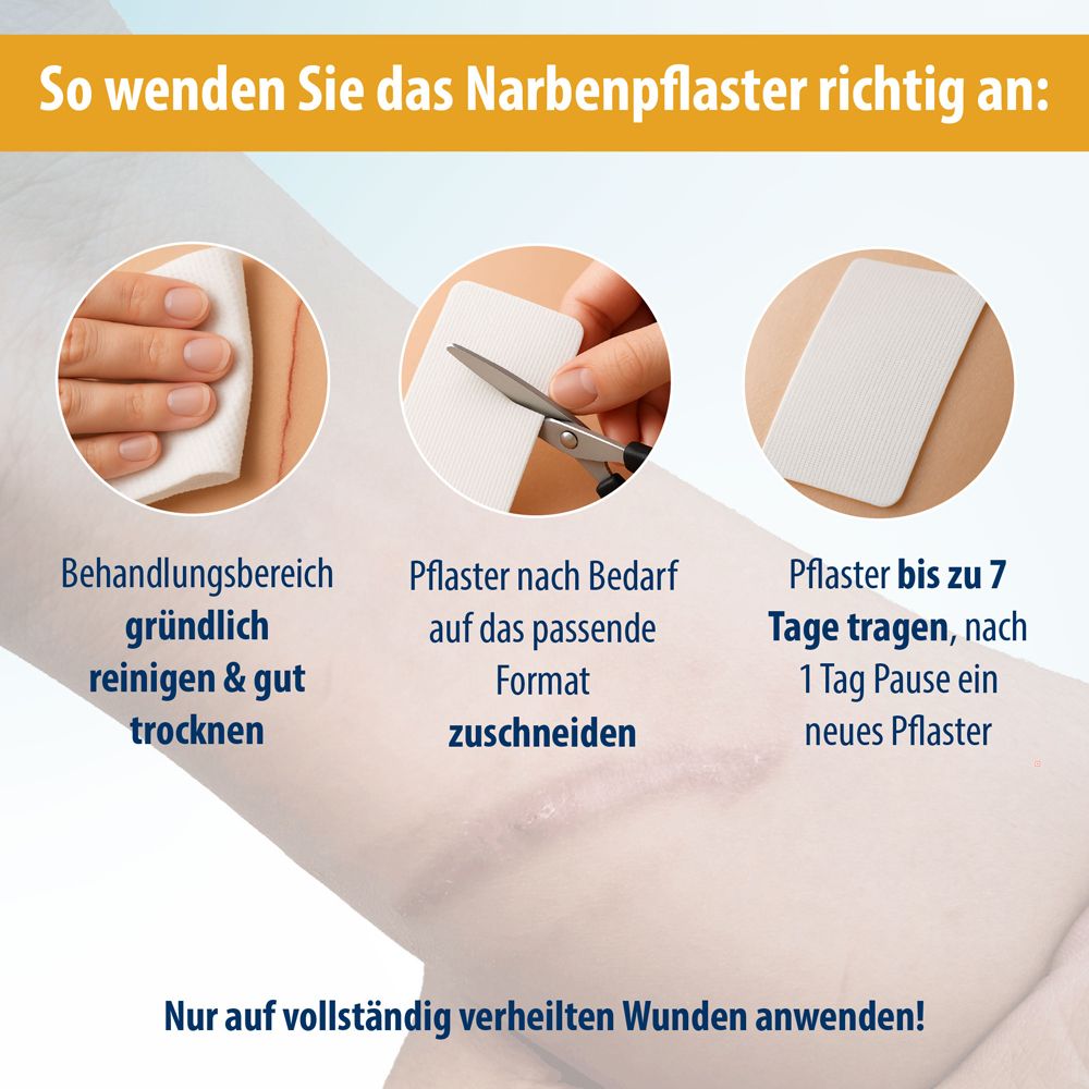 Anwendung des Narbenpflasters. Schritte: Reinigen, Zuschneiden, Tragen. Text: Nur auf vollständig verheilten Wunden anwenden!