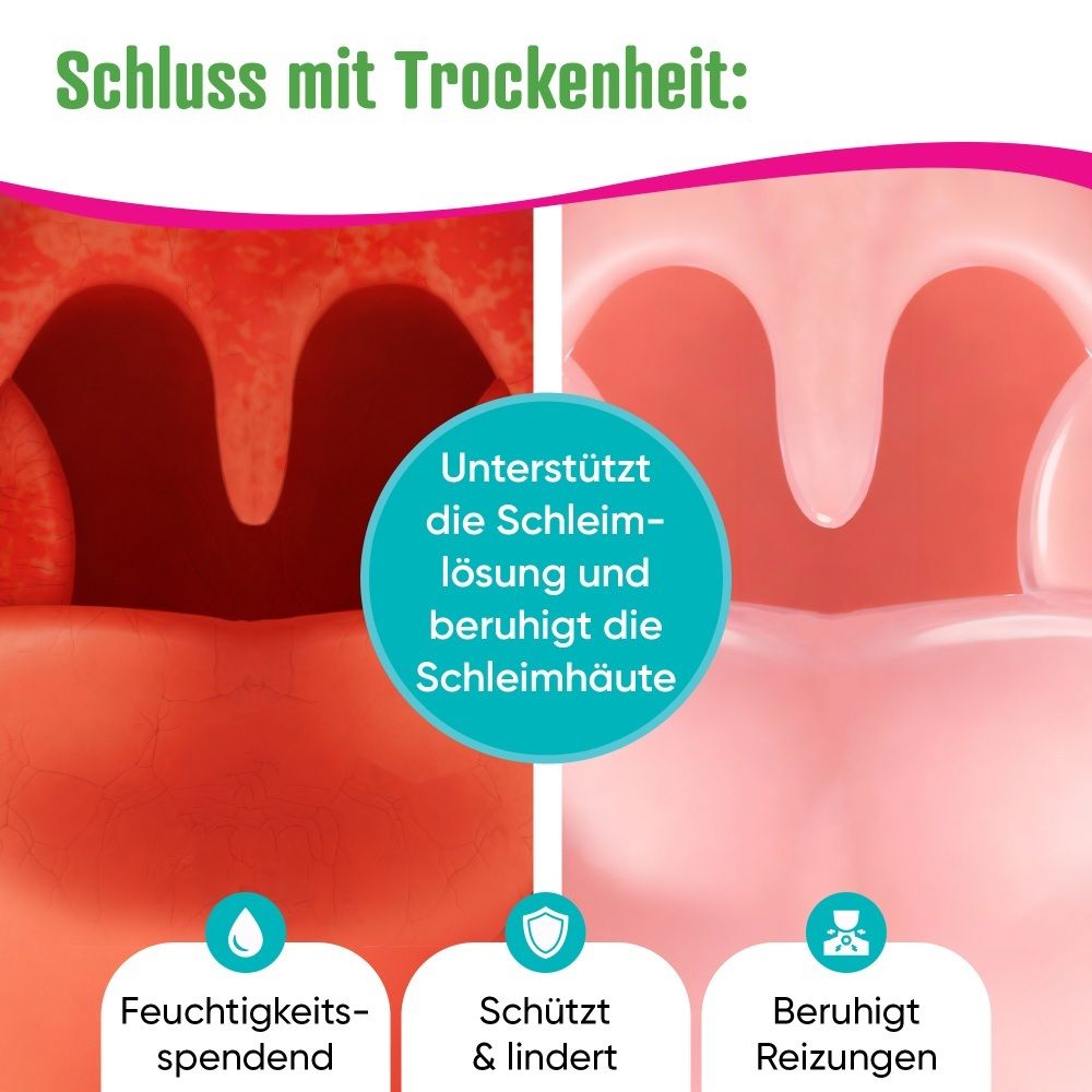 Vergleich: Gereizte und beruhigte Schleimhäute, mit Symbolen für Feuchtigkeitsspendend, Schützt & Lindert.