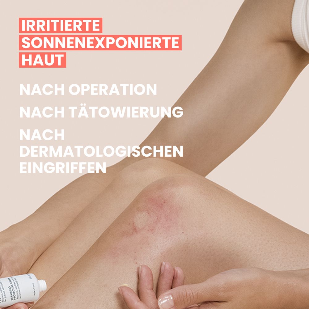 Bein mit Hautirritation; Text: Irritierte sonnenexponierte Haut, nach Eingriffen.