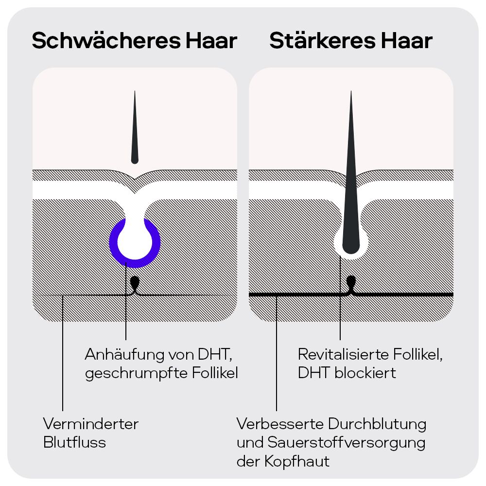 Diagramm: Haarfollikel. Links: Schwächeres Haar. Rechts: Stärkeres Haar. Text: Verminderter Blutfluss. Verbesserte Durchblutung.