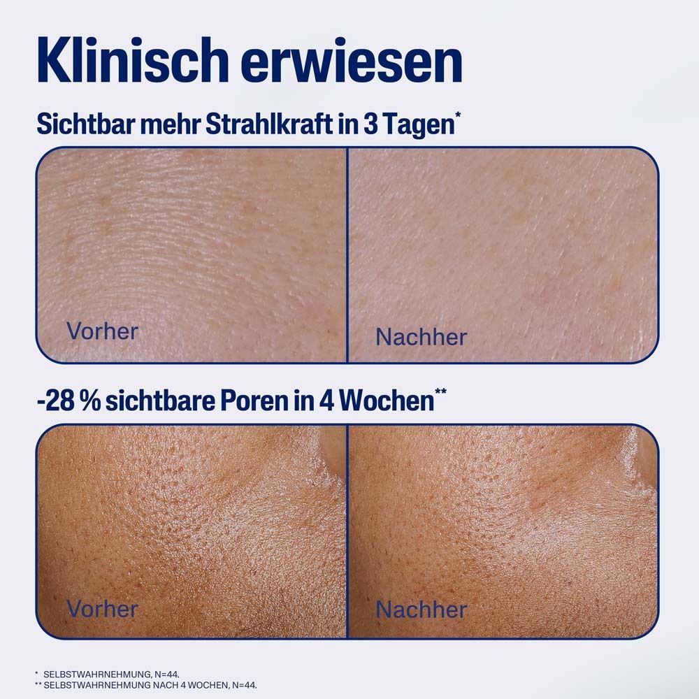 Vorher-Nachher-Vergleich. Hautbilder zeigen Verbesserung. Text: Klinisch erwiesen, sichtbar mehr Strahlkraft.
