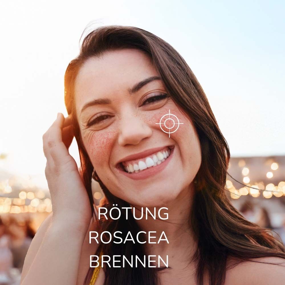 Frau mit geröteter Haut im Gesicht. Zielmarkierung auf der Wange. Text: Rötung, Rosacea, Brennen.