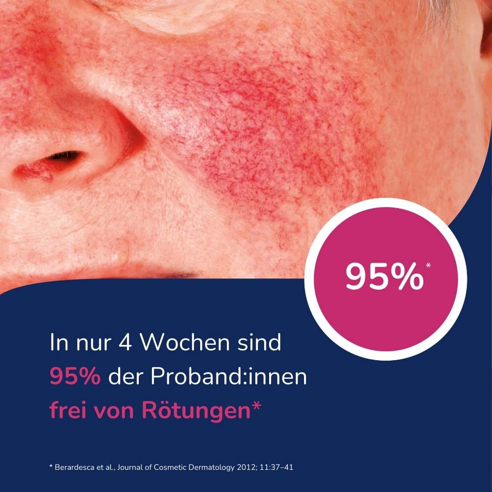 Gesicht mit geröteter Haut. Text: In 4 Wochen sind 95% der Proband:innen frei von Rötungen.