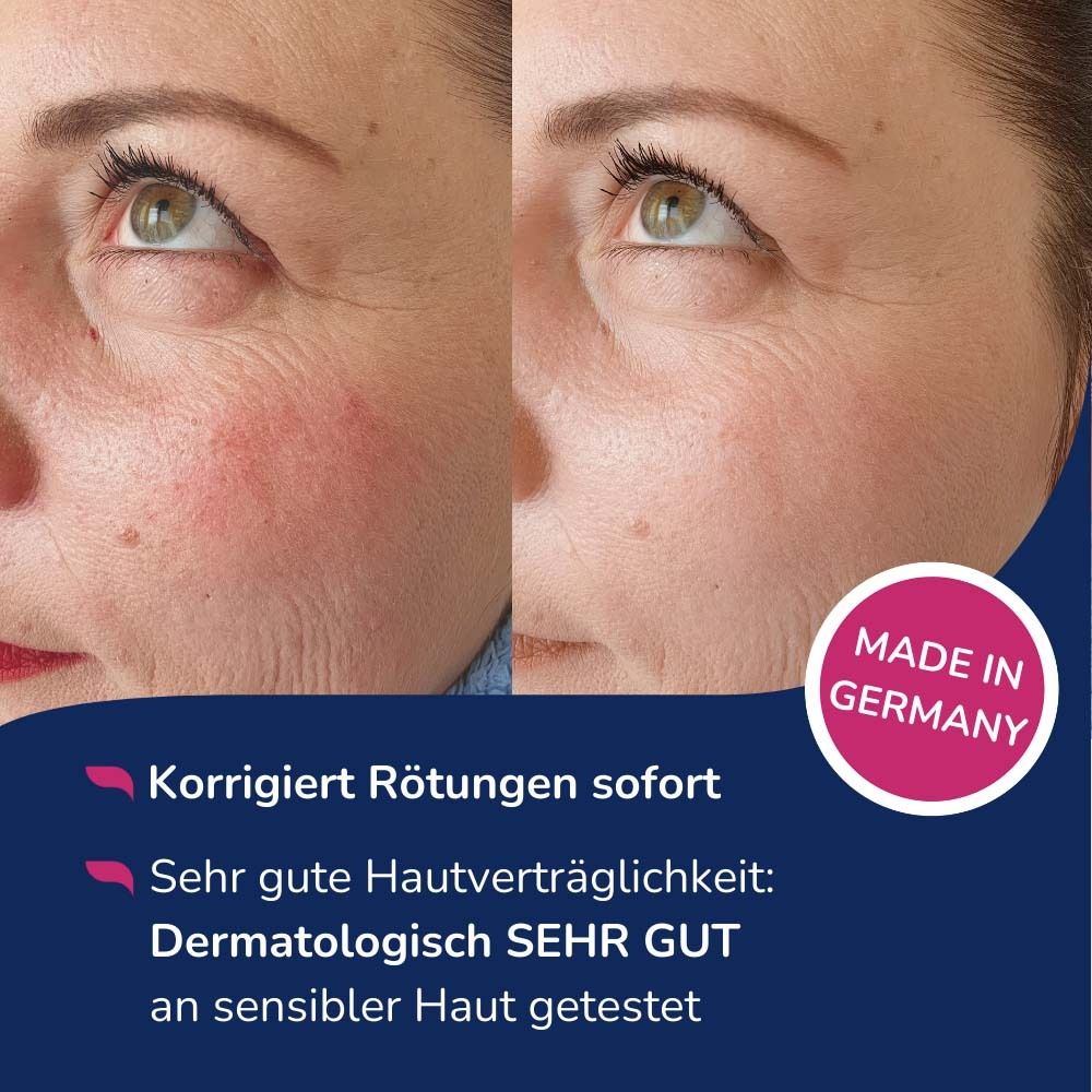 Gesicht mit Rötungen, Vorher-Nachher-Vergleich. Text: Korrigiert Rötungen sofort, Dermatologisch getestet.
