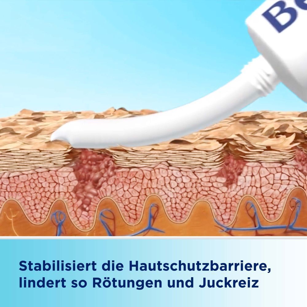 Illustration der Hautbarriere mit aufgetragener Creme, die Rötungen und Juckreiz lindert.