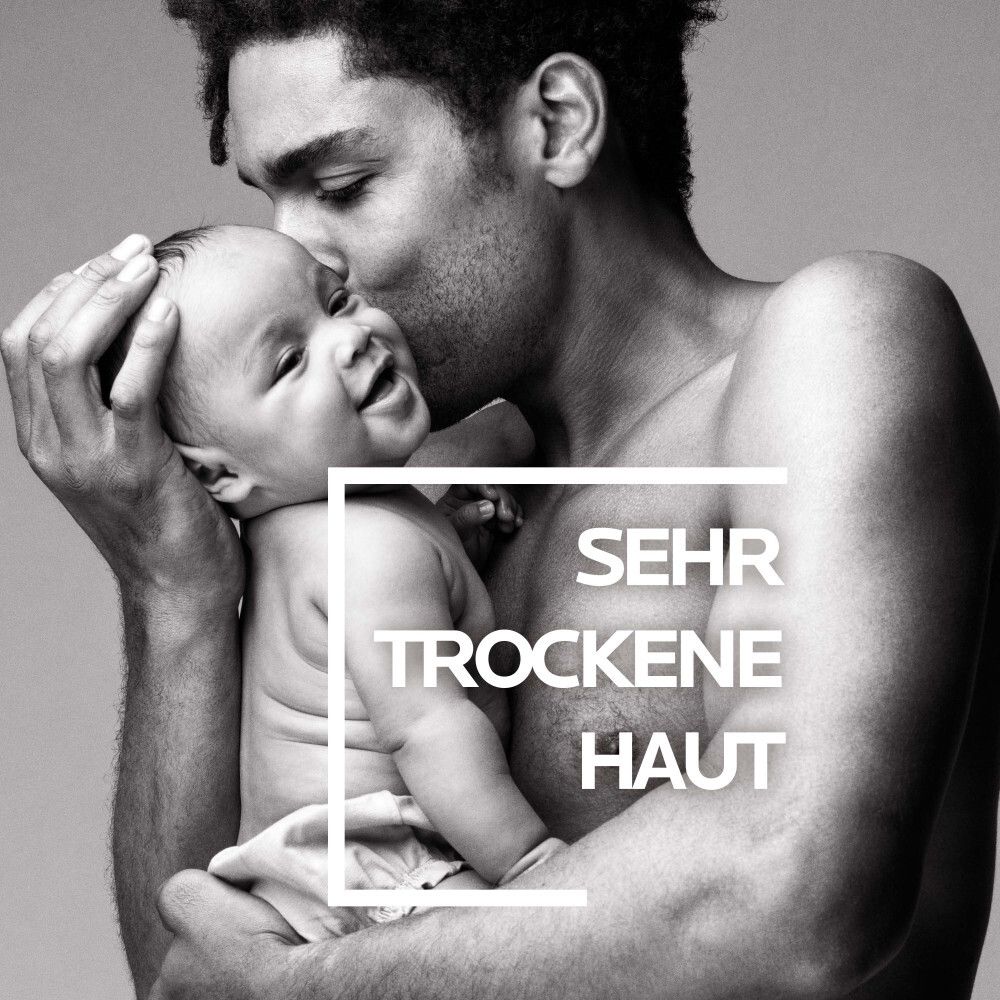 Mann umarmt Baby. Text: Sehr trockene Haut.