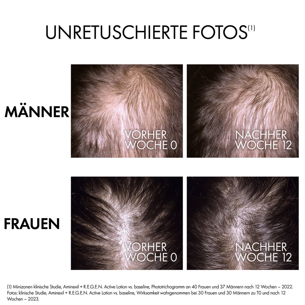 Vorher-Nachher-Fotos von Männern und Frauen. Text: Unretuschierte Fotos.