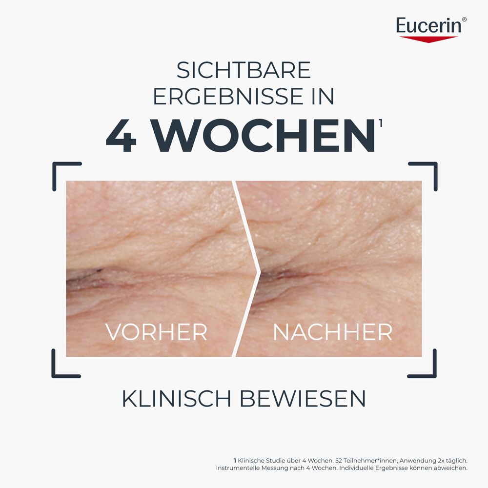 Vorher-Nachher-Vergleich der Haut nach 4 Wochen Anwendung. Klinisch bewiesen.