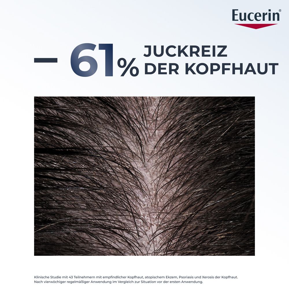 Nahaufnahme einer Kopfhaut mit Schuppen, Eucerin Text. Reduziert Juckreiz um 61%.