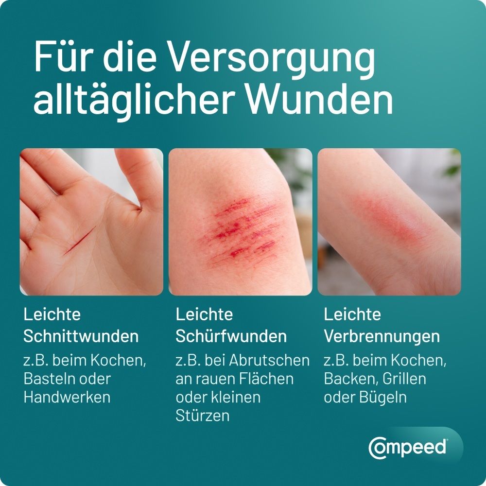 Compeed Pflaster für leichte Schnittwunden, Schürfwunden und Verbrennungen.