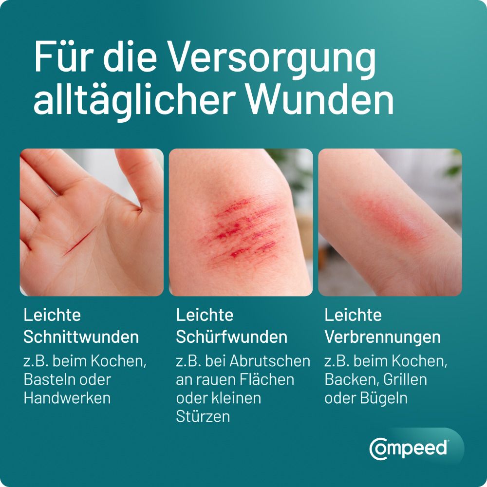 Compeed® für leichte Schnitt-, Schürf- und Brandwunden.