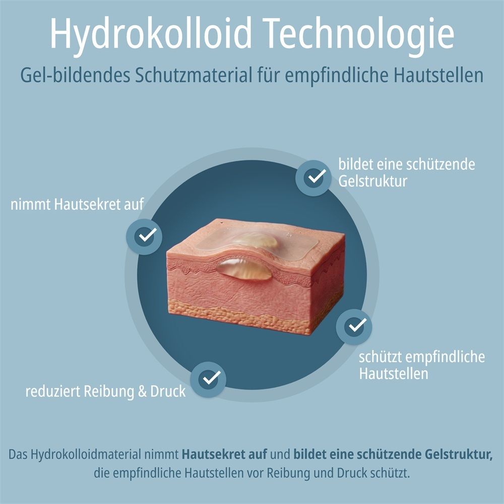 Hydrokolloid-Technologie: Gel-bildendes Material nimmt Hautsekret auf, bildet Gelstruktur, reduziert Reibung und schützt empfindliche Haut.