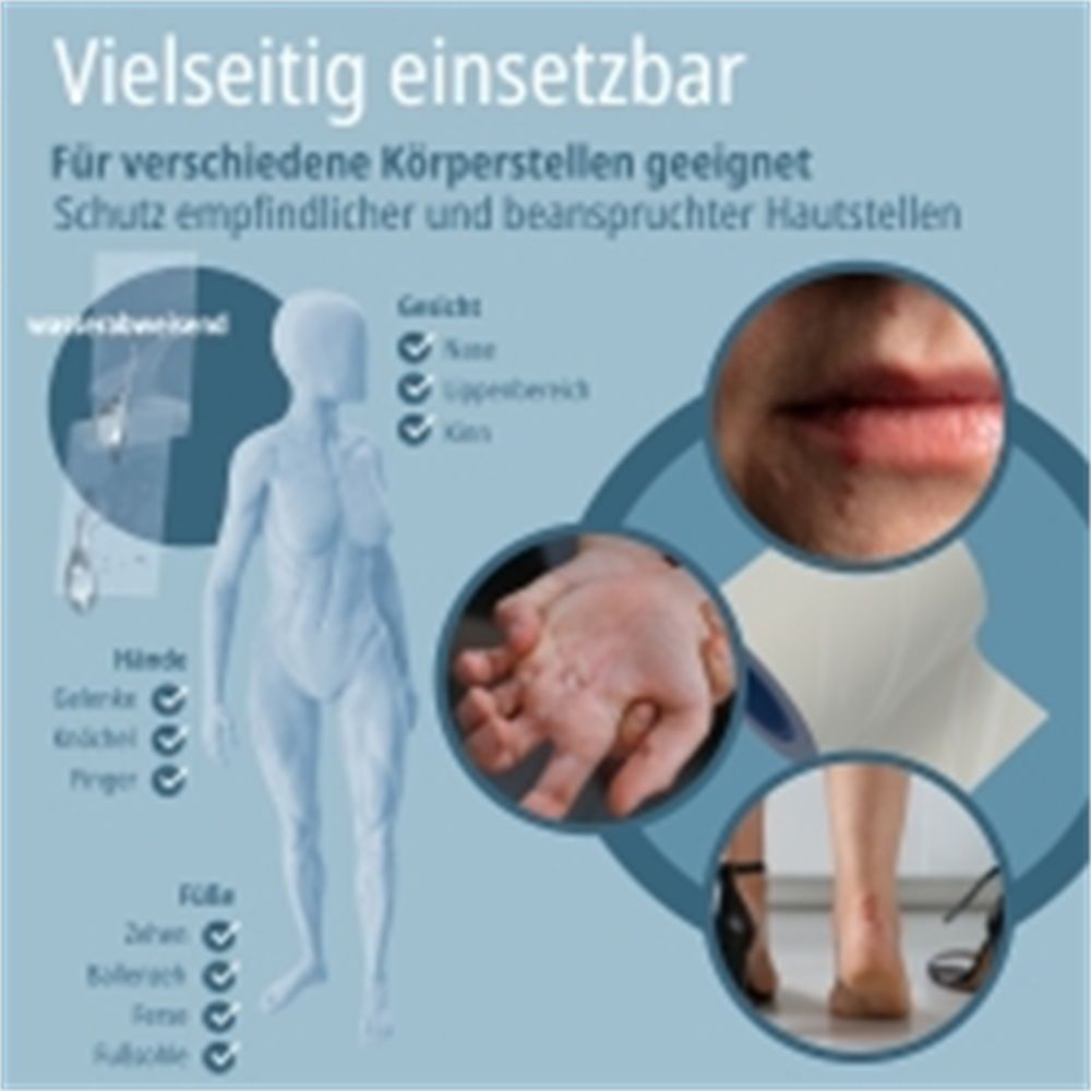 Illustration einer weiblichen Figur mit Markierungen für verschiedene Körperstellen. Nahaufnahmen von Lippen, Händen und Bein.