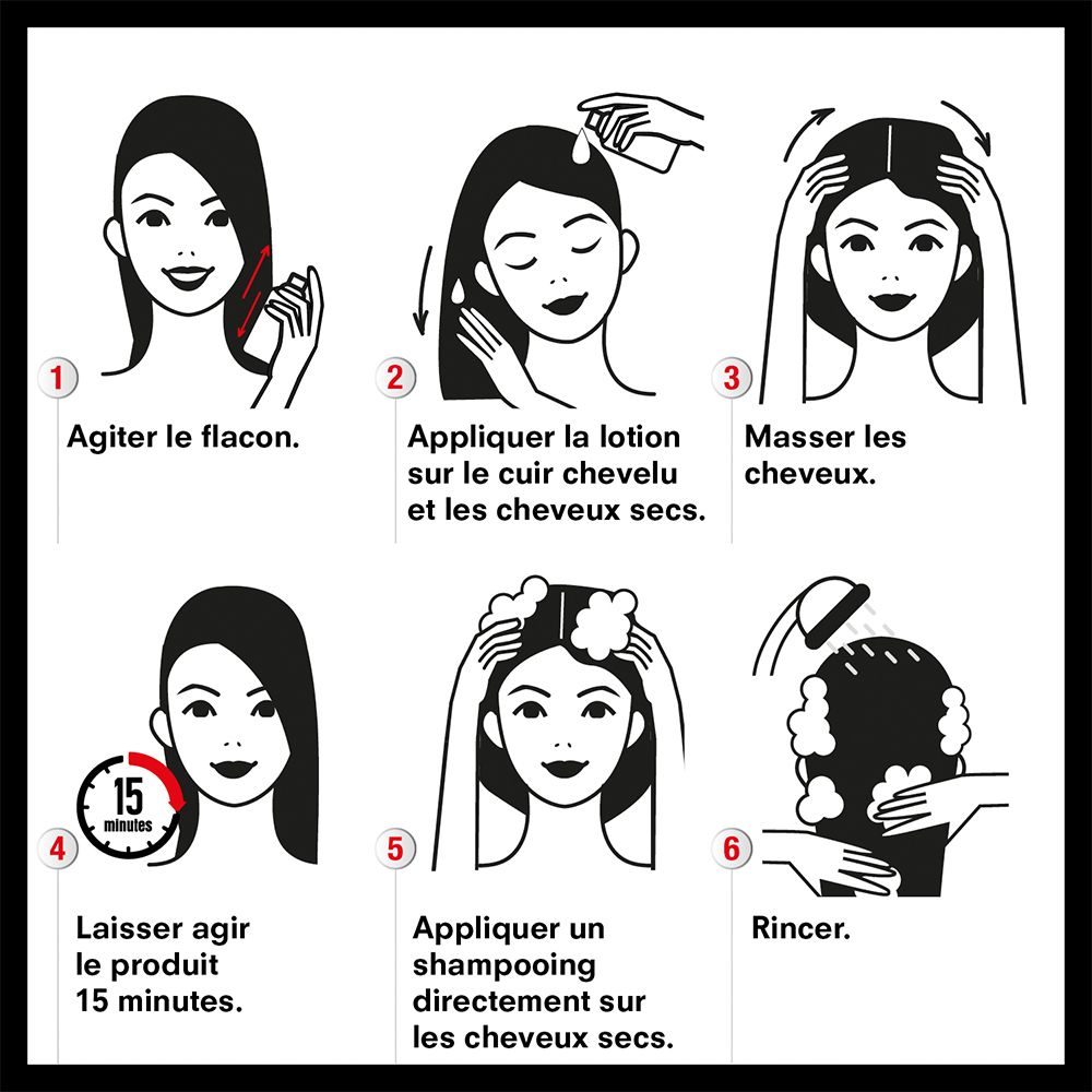 Instructions d'utilisation de Pouxit XF Lotion. Six étapes avec illustrations.