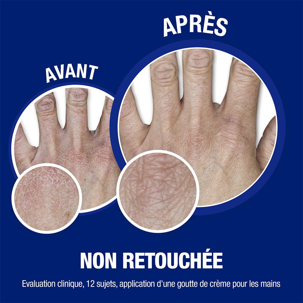 Comparaison des mains avant et après utilisation. Texte : Non retouchée. Fond bleu.