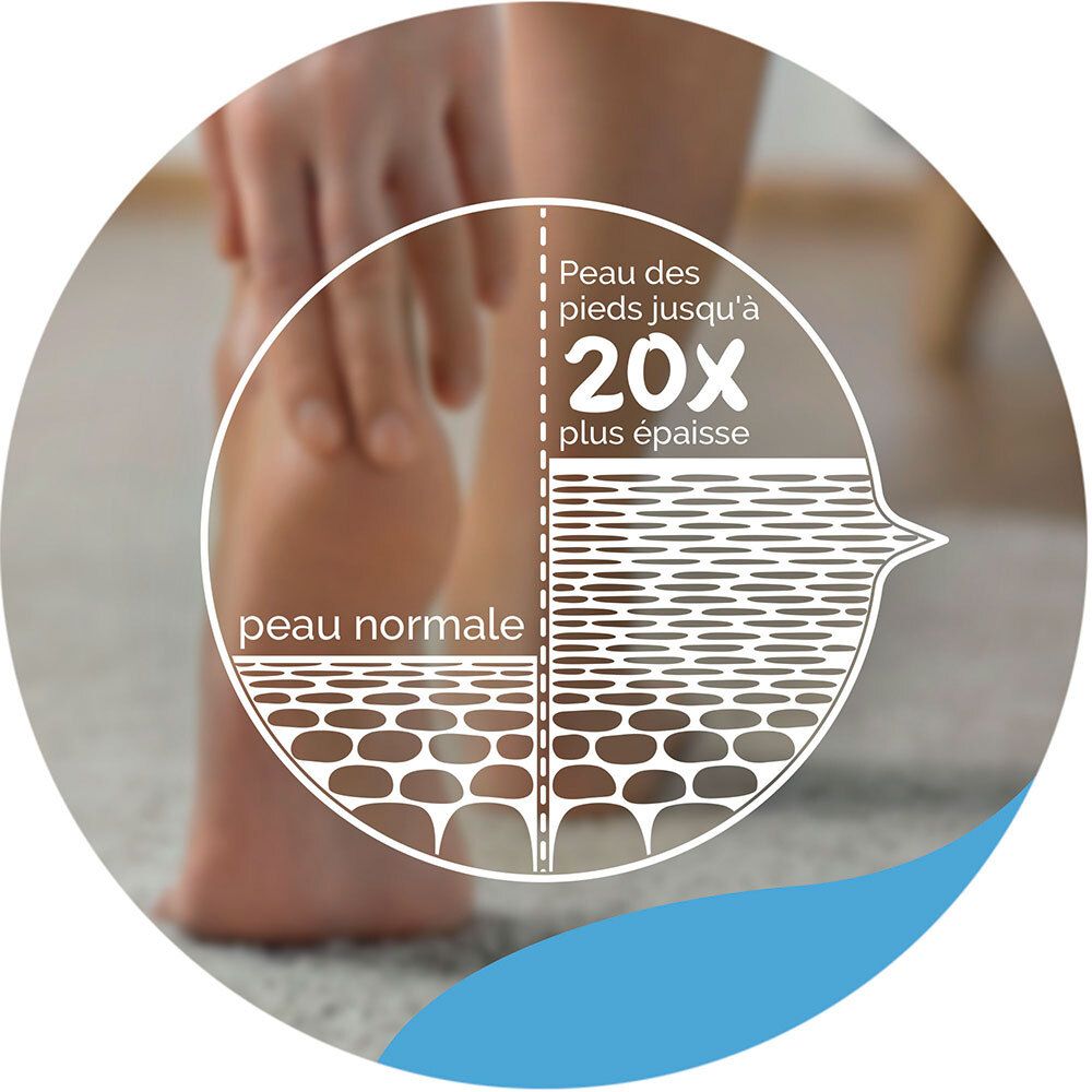 Image circulaire. Pied et comparaison des couches de peau. Texte : 20x plus épais.