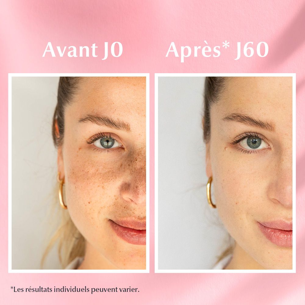 Images avant-après du visage. Texte: Résultats après 60 jours.