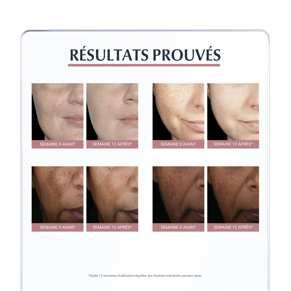 Images avant-après de visages. Texte : Résultats après 12 semaines. Eucerin® Anti-Pigment.