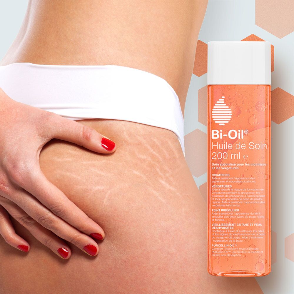 Femme avec flacon Bi-Oil®. Liquide rose, bouchon blanc. Peau.