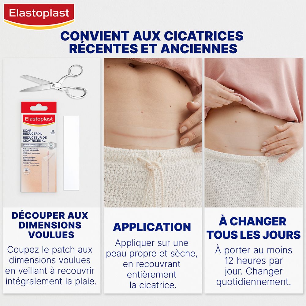 Ventre avec cicatrices. Ciseaux, patchs et instructions. Application : peau propre, 12 heures par jour.