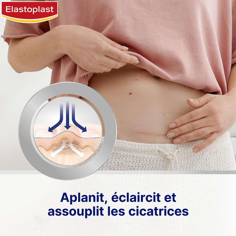 Ventre avec cicatrices. Graphique : aplatit, éclaircit et assouplit les cicatrices.