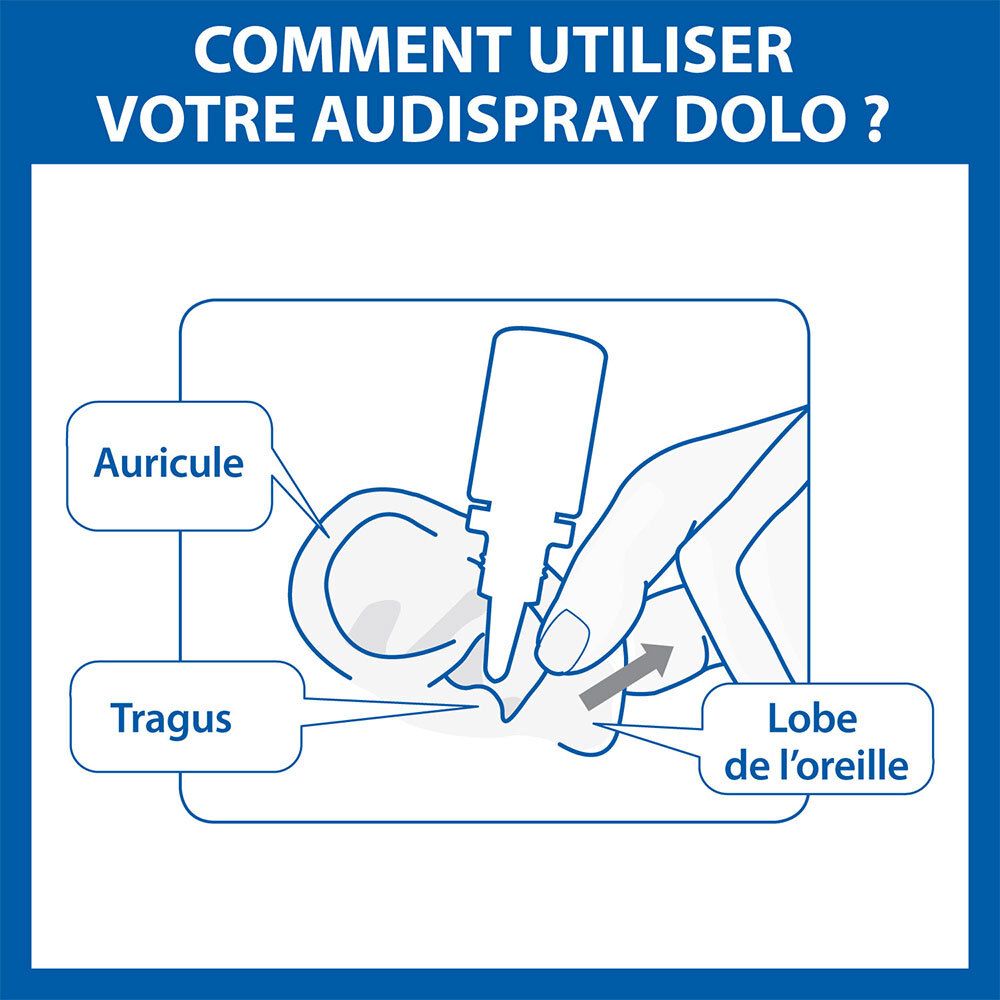 Illustration : Utilisation des gouttes auriculaires. Montre oreille, tragus et lobe.
