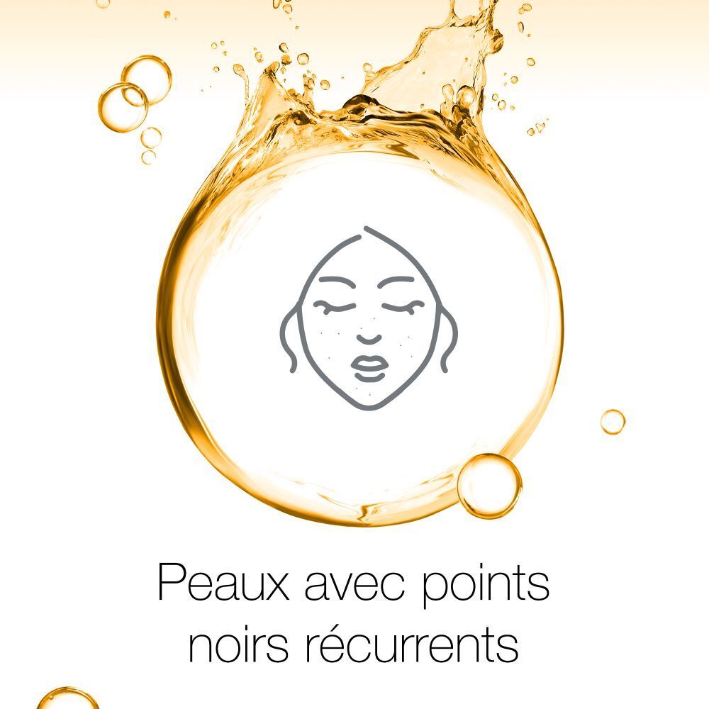 Graphique avec visage et points noirs. Texte : Peaux avec points noirs récurrents.