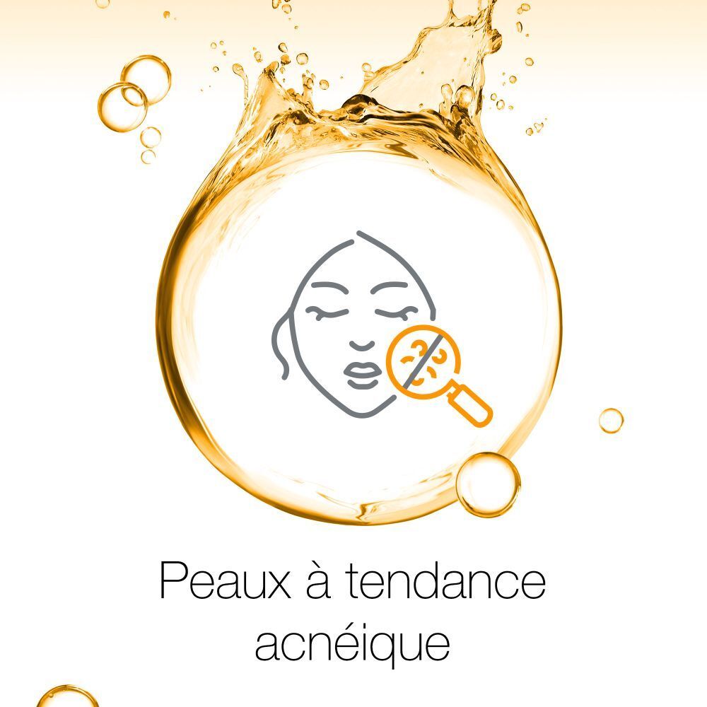 Icône d'un visage avec une loupe dans un cercle doré. Texte: Peaux à tendance acnéique.