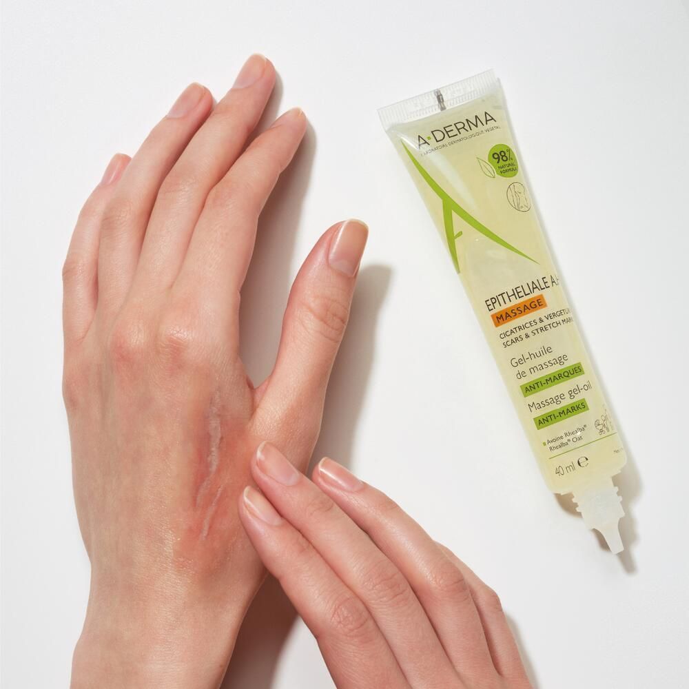Main avec cicatrice, à côté du tube de gel-huile A-DERMA Epitheliale A.H Massage.