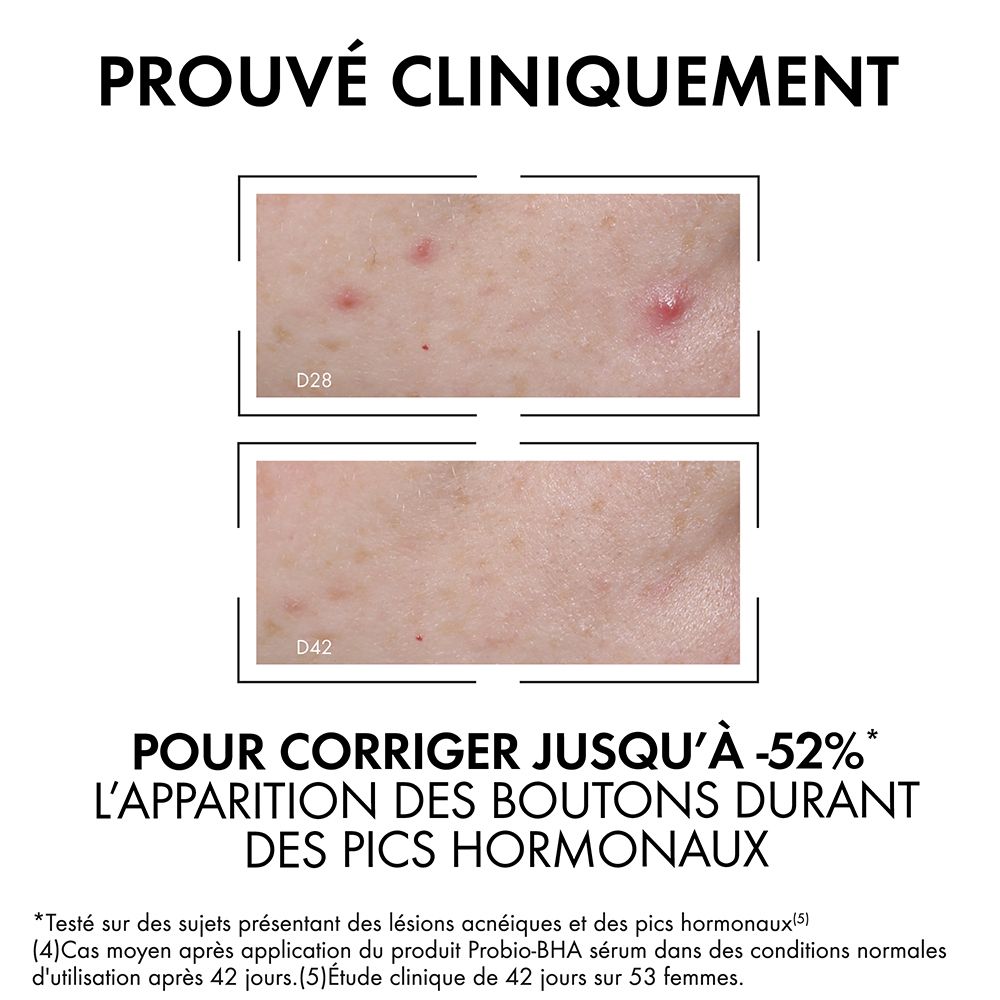 Images comparatives d'imperfections cutanées. Texte: Prouvé cliniquement. Pour corriger jusqu'à -52% des boutons.