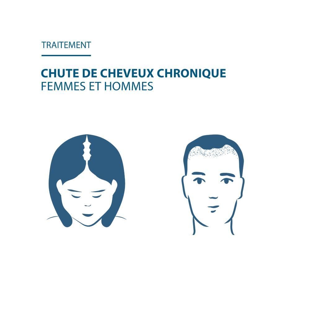 Twee gestileerde hoofden, vrouw en man. Tekst: Chronische haaruitval, vrouwen en mannen.