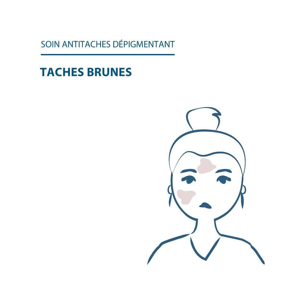 Dessin d'un visage avec taches pigmentaires. Texte: Soin anti-taches.