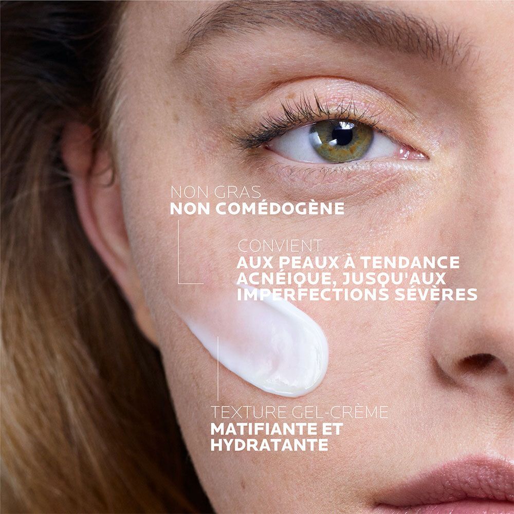Gezicht met crème. Tekst: Niet vet, niet comedogeen. Voor acnegevoelige huid. Gel-crème textuur.