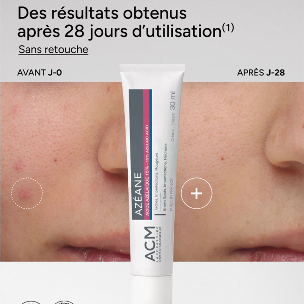 ACM Azéane Creme mit 15% Azelainsäure zur Behandlung von Hautunreinheiten und Flecken. 30 ml Tube.