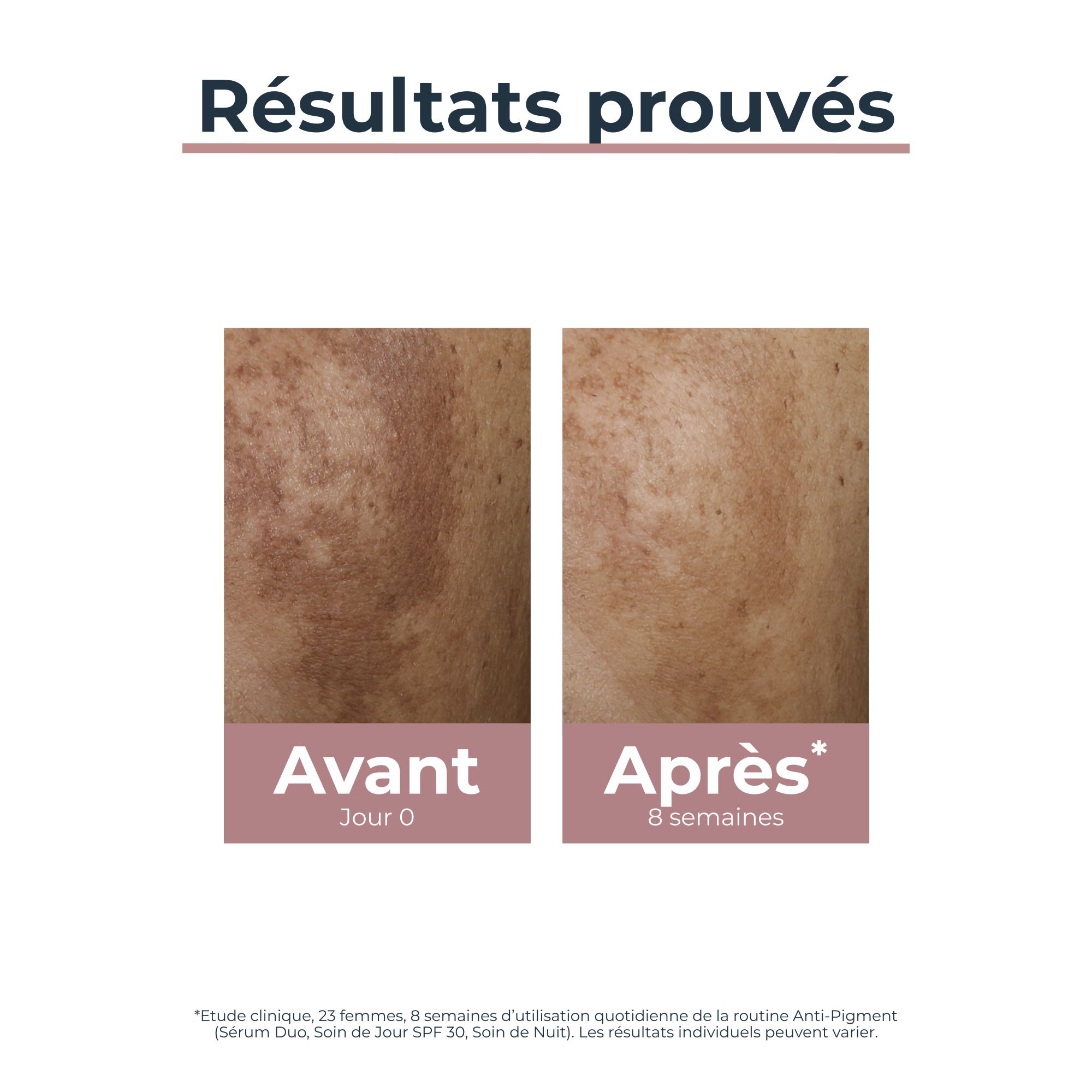 Images avant-après. Texte : Avant, Jour 0. Après, 8 semaines.