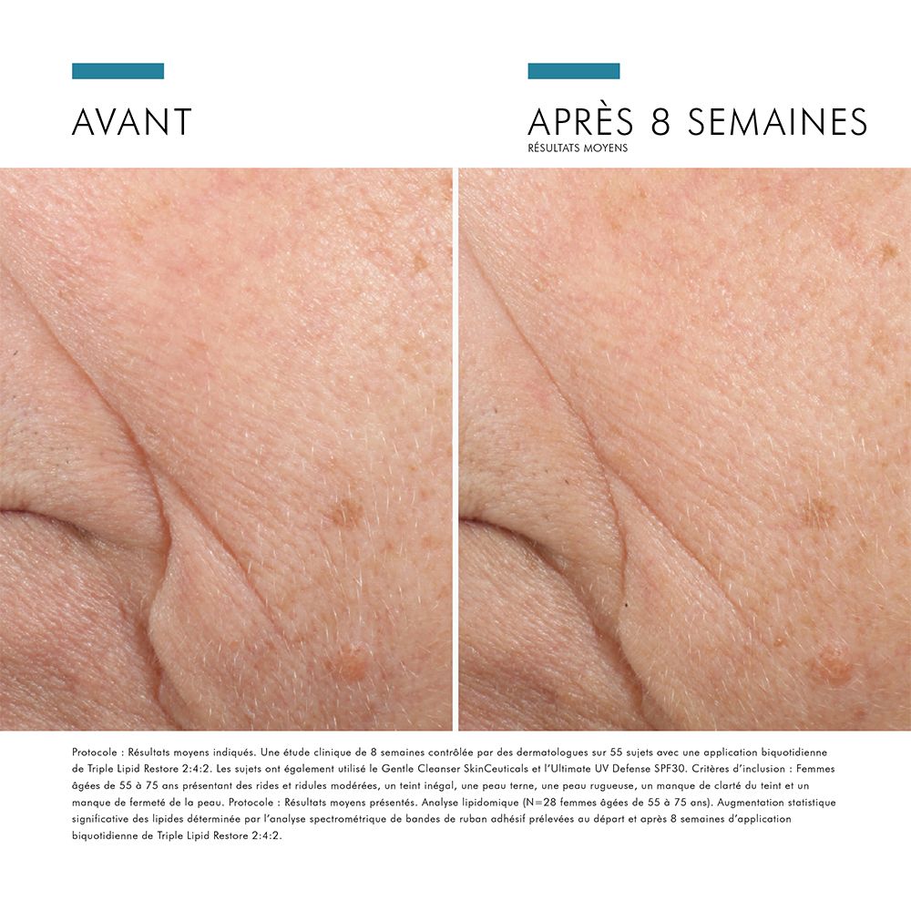 Comparaison avant-après de la peau. Texte : Résultats après 8 semaines. Peau ridée et peau moins ridée.