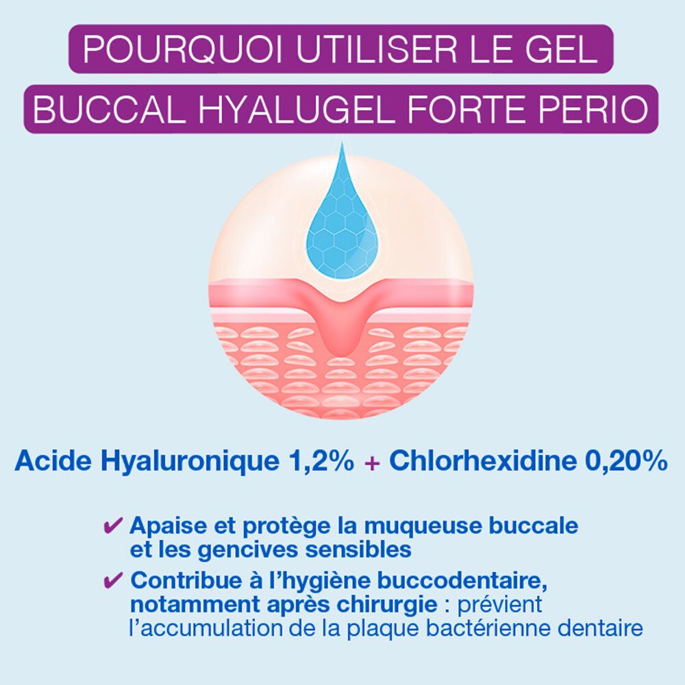 Graphique des avantages du produit. Illustration des gencives. Texte: Acide Hyaluronique, Chlorhexidine, Apaise, Contribue.