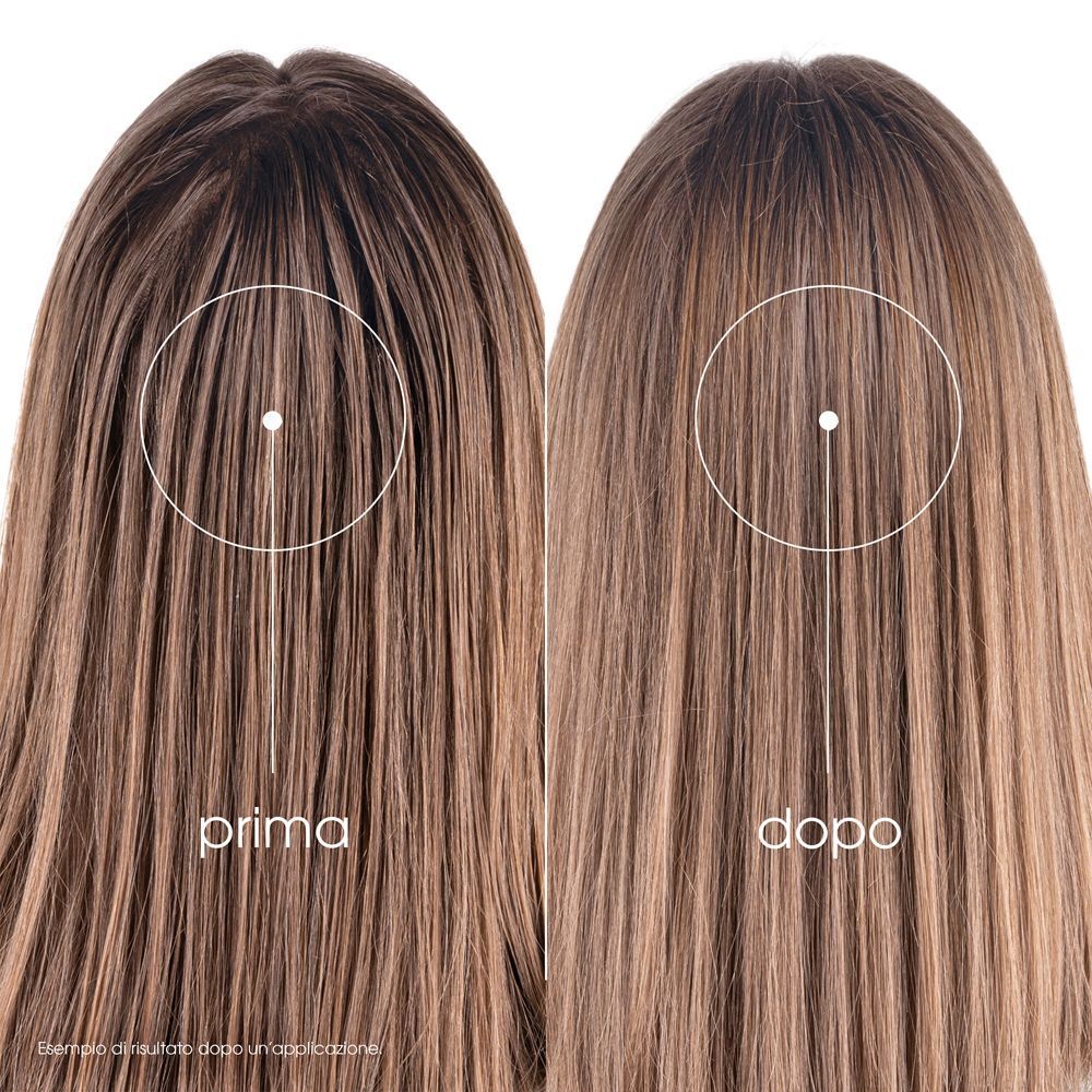 Klorane  Shampoo secco all'ortica e Vitamina E 150ml  - Capelli grassi, scuri, purificante - risparmia il 10% con il codice: pfabre10