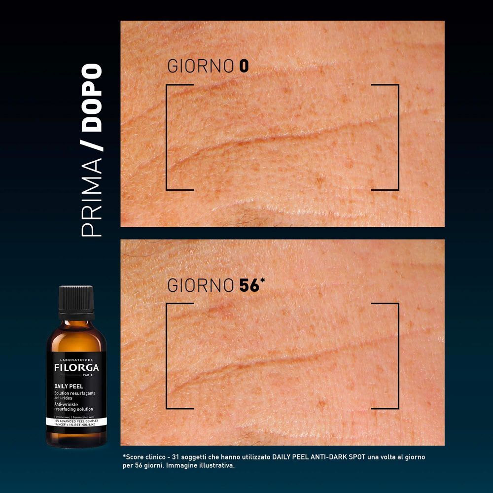 Confronto prima/dopo di pelle rugosa trattata con Filorga Daily Peel.