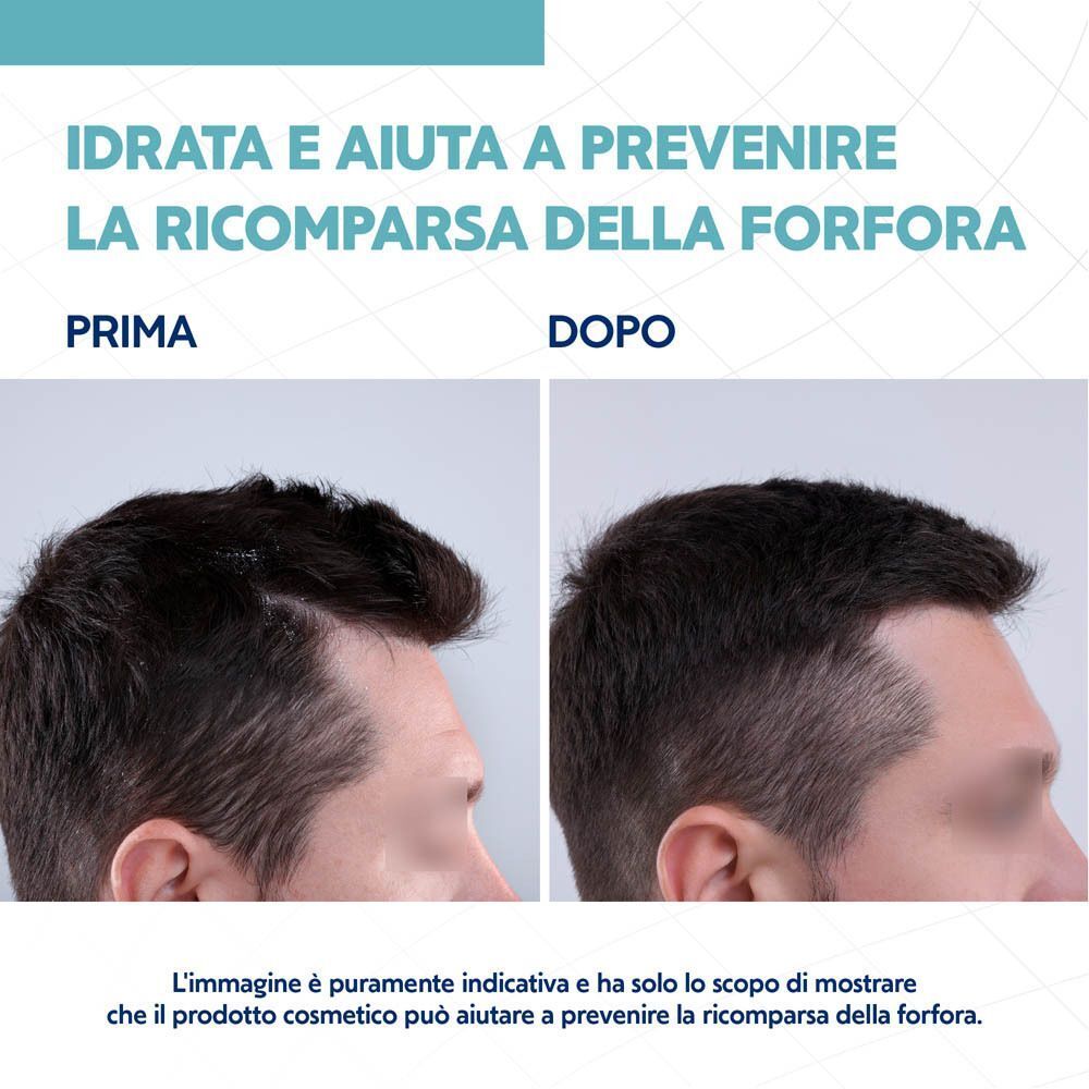 Nizoral Care Shampoo Cute Secca e Sensibile